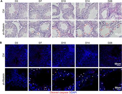 A Novel Meiosis-Related lncRNA, Rbakdn, Contributes to Spermatogenesis by Stabilizing Ptbp2